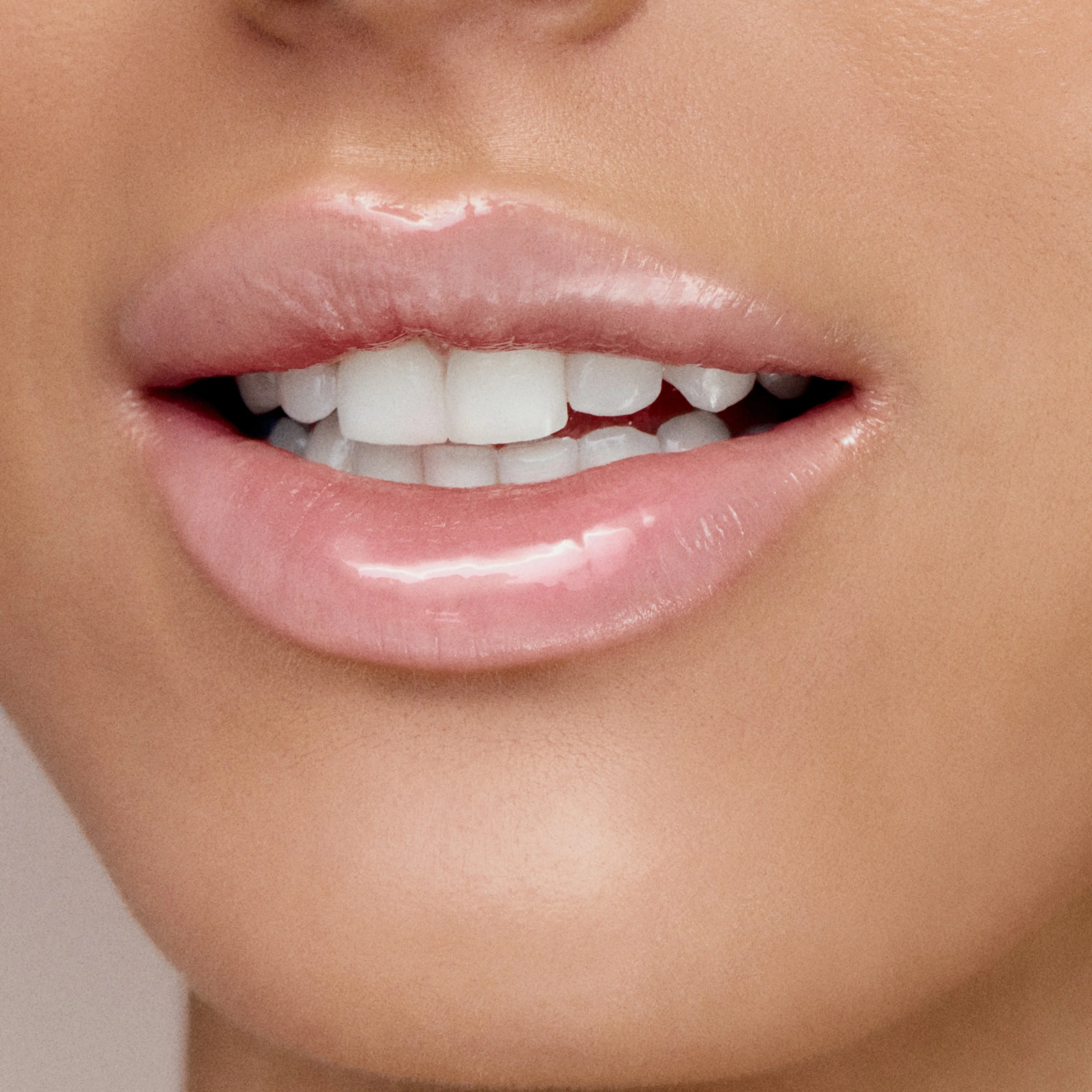 Thumbnail 17